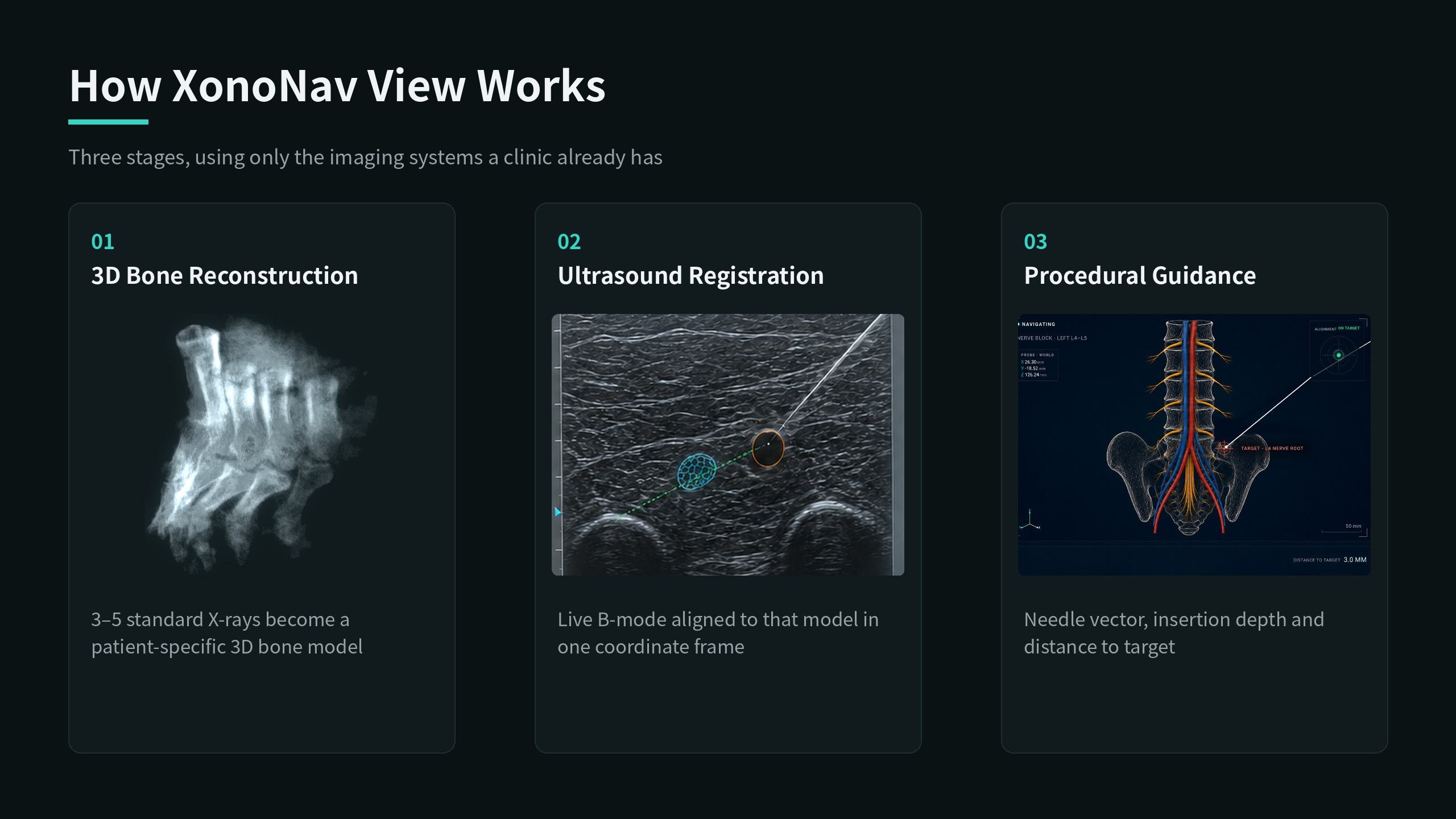 Patient-specific 3D from standard X-rays