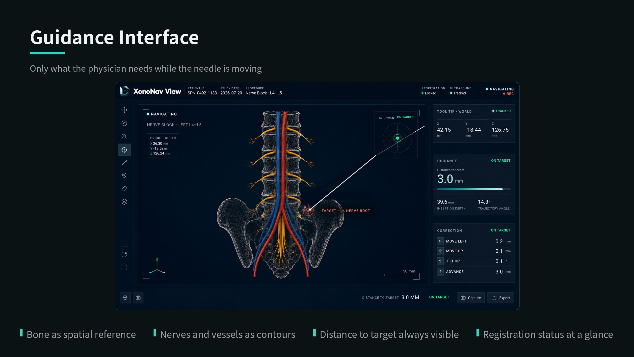 Bone and soft tissue in one view