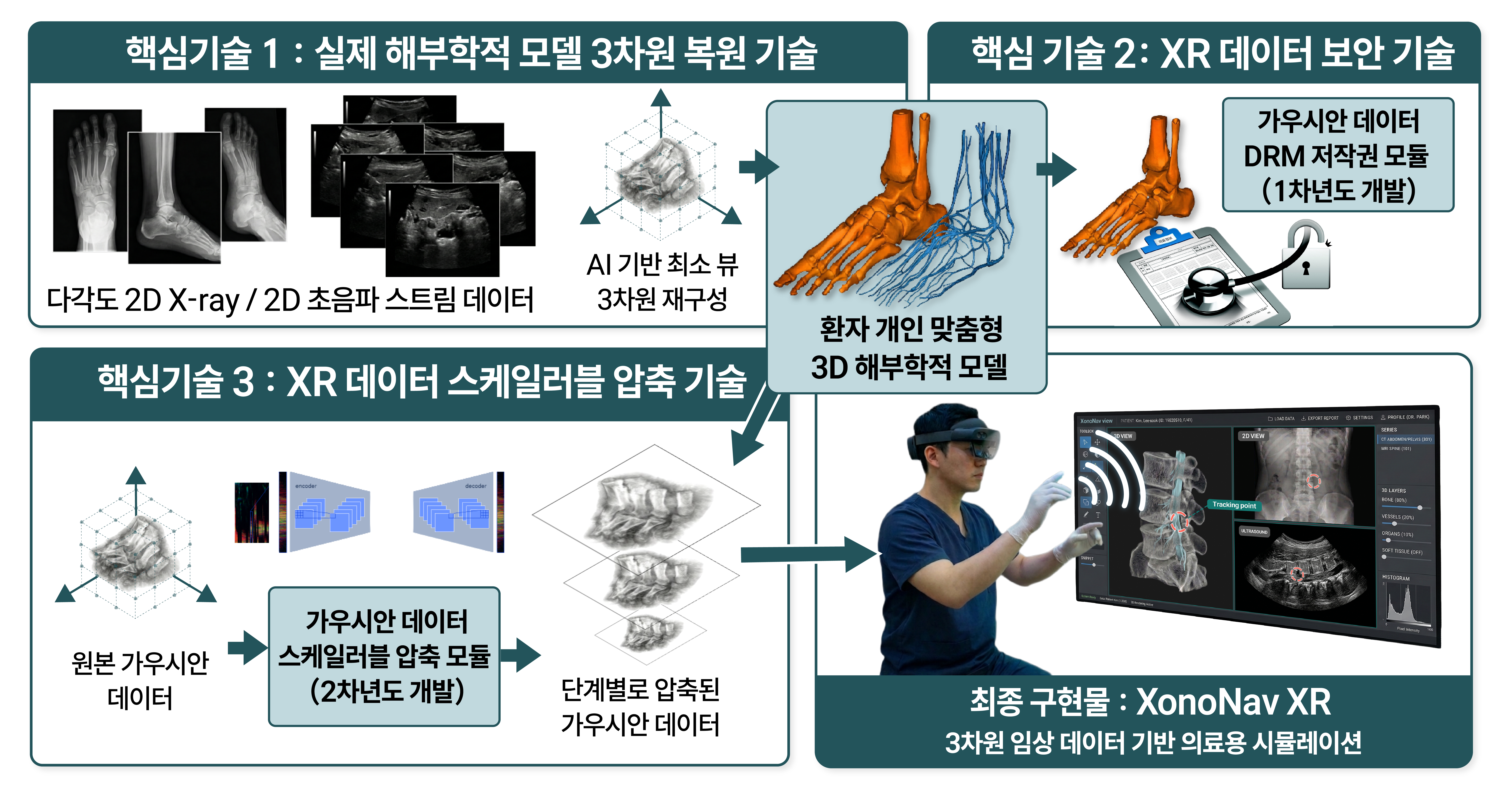 XonoNav XR preview